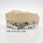 Custom 8pcs 3D Floral Engraved Grillz: 925 Sterling Silver (Free Mold Kit)