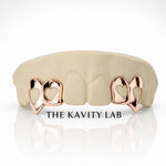 Custom 4pcs Open Hearts Style Grillz: 925 Sterling Silver (Free Mold Kit)