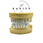 Custom Diamond Cut Sterling Silver Grillz: Dust & Perm Style