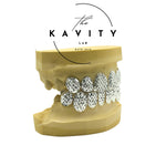 Custom Diamond Cut Sterling Silver Grillz: Dust & Perm Style