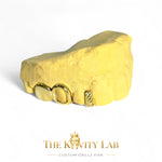 Custom 3pc Open Face x Diamond Cuts Gap Filler GRILLZ: 925 Sterling Silver (Free Mold Kit)