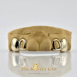 Custom 4pcs Solid Class x Open Face Grillz: 925 Sterling Silver (Free Mold )