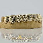 Custom Diamond Cut x Dust Grillz: 925 Sterling Silver (Free Mold Kit)