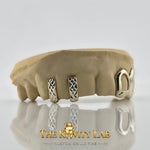 Custom 6pcs Gap Filler x Open Face Grillz: 925 Sterling Silver (Free Mold Kit)