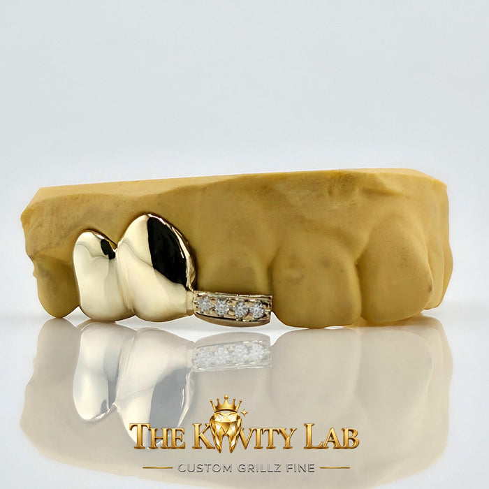 Custom 3pcs Plain Jane x Moissanite Tip Grillz: 925 Sterling Silver (Free Mold Kit)