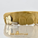 Custom 3pcs Plain Jane x Moissanite Tip Grillz: 925 Sterling Silver (Free Mold Kit)