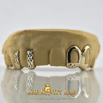 Custom 6pcs Gap Filler x Open Face Grillz: 925 Sterling Silver (Free Mold Kit)