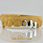 Custom 3pc Open Face x Solid Caps Grillz: 925 Sterling Silver (Free Mold Kit)