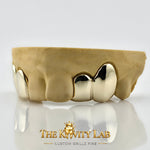 Custom 4pcs Solid Class: 925 Sterling Silver (Free Mold Kit)