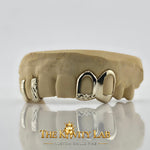 Custom 6pcs Gap Filler x Open Face Grillz: 925 Sterling Silver (Free Mold Kit)