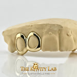 Custom 2pcs Open Face Grillz: 925 Sterling Silver (Free Mold Kit)