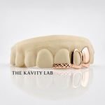 Custom 3pcs Diamond Cuts & Open-Face Grillz : 925 Sterling Silver (Free Mold Kit)