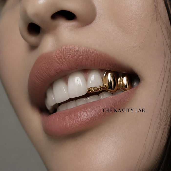 Custom 3pc Rose Detail x Solid Caps Grillz: 925 Sterling Silver (Free Mold Kit)