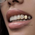 Custom 3pcs Open Face x Moissanite Tip Grillz: 925 Sterling Silver (Free Mold Kit)