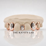 Custom 6pcs Gap Filler x Diamond Cuts Grillz: 925 Sterling Silver (Free Mold Kit)