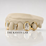 Custom 6pcs Gap Filler x Diamond Cuts Grillz: 925 Sterling Silver (Free Mold Kit)