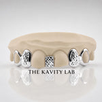 Custom 6pcs Gap Filler x Diamond Cuts Grillz: 925 Sterling Silver (Free Mold Kit)