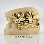 Custom 6pcs Diamond Cuts and Dust Box Grillz: 925 Sterling Silver (Free Mold Kit)