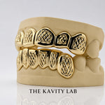 Custom 6pcs Diamond Cuts and Dust Box Grillz: 925 Sterling Silver (Free Mold Kit)