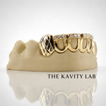 Custom 6pcs Iced Out Front Bar x Diamond Cuts Grillz: 925 Sterling Silver (Free Mold Kit)