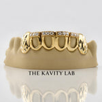 Custom 6pcs Iced Out Front Bar x Diamond Cuts Grillz: 925 Sterling Silver (Free Mold Kit)