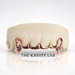 Custom 6pc Curved Front Bar and Diamond Cut Grillz: 925 Sterling Silver (Free Mold Kit)