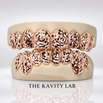 Custom Roses Cuts x Dust Grillz: 925 Sterling Silver Rose Gold Plated (Free Mold Kit)
