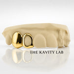 Custom 2pcs Solid x Open Face Grillz: 925 Sterling Silver (Free Mold Kit)