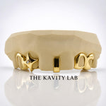 Custom 6pcs 3D Star x Open Face Grillz: 925 Sterling Silver (Free Mold Kit)