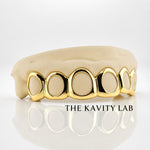 Custom 6pcs Open Face Style Grillz: 925 Sterling Silver (Free Mold Kit)