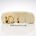 Custom 3pcs Open Face & Gap Filler Grillz: 925 Sterling Silver (Free Mold Kit)