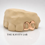 Custom 2pc Open Heart with Open Face Grillz: 925 Sterling Silver (Free Mold Kit)