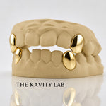 Custom 2pcs Solid Fangs: 925 Sterling Silver (Free Mold Kit)
