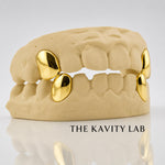 Custom 2pcs Solid Fangs: 925 Sterling Silver (Free Mold Kit)