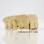 Custom 3pcs Open Face with Gap Filled Grillz: 925 Sterling Silver (Free Mold Kit)