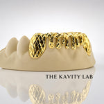 Custom 6pcs Diamond Cut x Dripping Style Grillz: 925 Sterling Silver (Free Mold Kit)