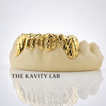 Custom 6pcs Diamond Cut x Dripping Style Grillz: 925 Sterling Silver (Free Mold Kit)