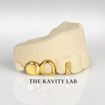 Custom 3pc Open Face x Diamond Cuts Gap Filler GRILLZ: 925 Sterling Silver (Free Mold Kit)