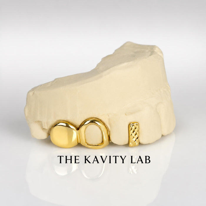 Custom 3pc Open Face x Diamond Cuts Gap Filler GRILLZ: 925 Sterling Silver (Free Mold Kit)