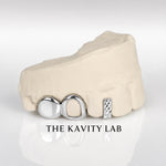 Custom 3pc Open Face x Diamond Cuts Gap Filler GRILLZ: 925 Sterling Silver (Free Mold Kit)