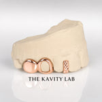 Custom 3pc Open Face x Diamond Cuts Gap Filler GRILLZ: 925 Sterling Silver (Free Mold Kit)