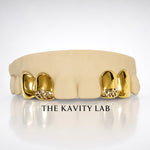 Custom 4pcs White Diamond Cuts Grillz: 925 Sterling Silver (Free Mold Kit)
