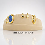 Custom 8pcs Blue Opal with Stars Grillz: 925 Sterling Silver (Free Mold Kit)