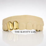 Custom 2pc Plain Jane Soild Grillz: 925 Sterling Silver (Free Mold Kit)