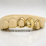 Custom 3pcs Open Face and Starburst Cuts Grillz: 925 Sterling Silver (Free Mold Kit)