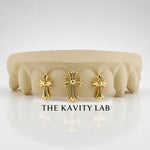 Custom 4pcs 3D Cross Trio Grillz: 925 Sterling Silver (Free Mold Kit)