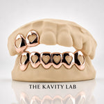 Custom Set 2pc on 6pc Open Hearts Grillz: 925 Sterling Silver (Free Mold Kit)