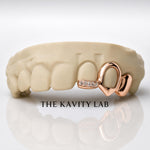 Custom 3pcs Open Face and Moissanite Tip Grillz: 925 Sterling Silver (Free Mold Kit)