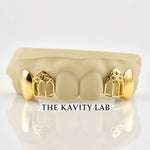 Custom 4pcs Solid x Gothic Window Grillz: 925 Sterling Silver (Free Mold Kit)