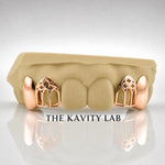 Custom 4pcs Solid x Gothic Window Grillz: 925 Sterling Silver (Free Mold Kit)